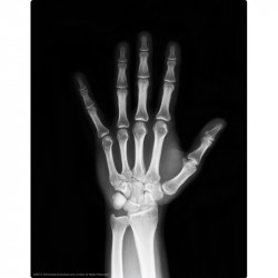 4M emberi csontváz készlet